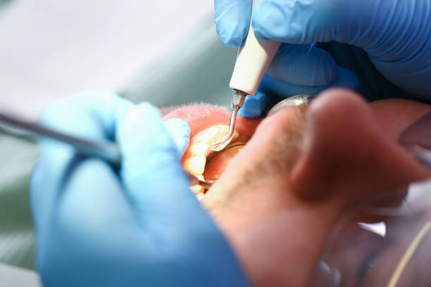 Best Teeth Whitening  in Houghton, NY